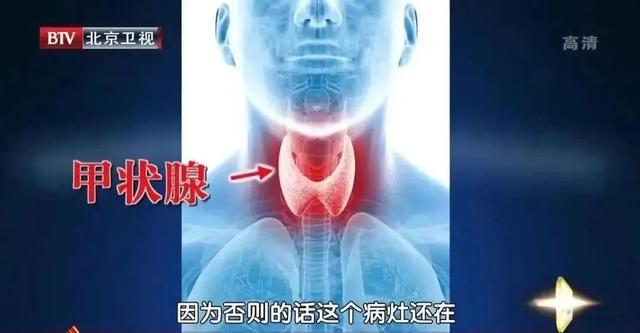 警惕！睡前玩手机会变丑！小心还有这些病找上你……