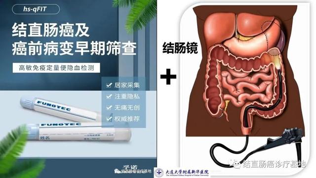 高危人群，要提前進行結直腸癌篩查與早診