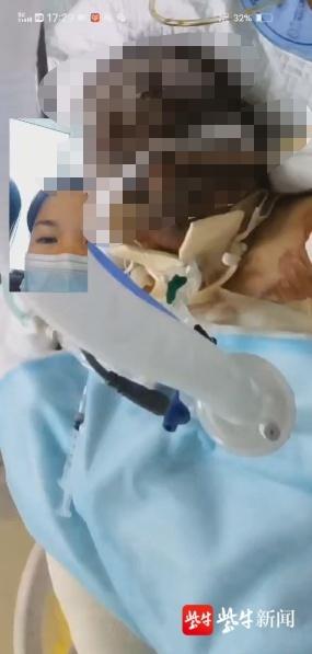 丈夫火灾中救下的妻子因感染离世，家属：很突然，明明第二次手术后都是好好的