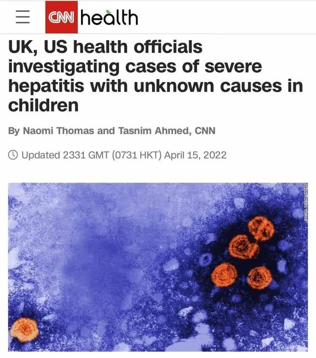 英国率先报告数十例儿童不明原因急性肝炎后多国陆续出现，源头不明
