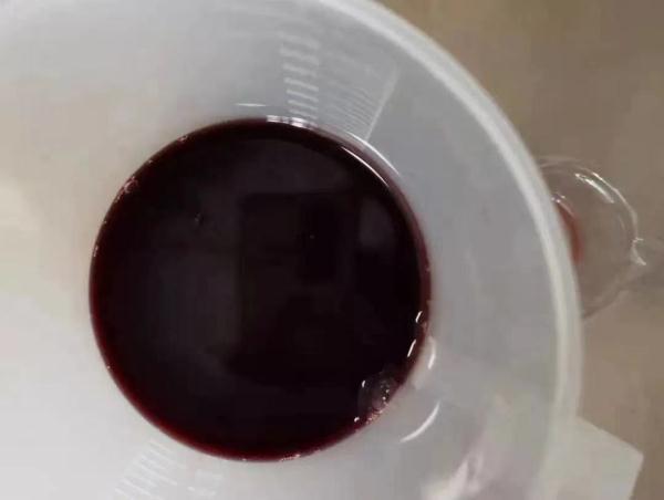 近期高发！男孩几粒豆下肚，尿出“酱油”高烧不退