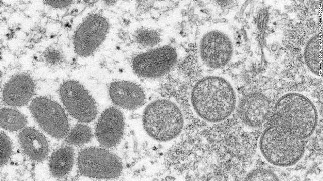 美国监测到6人可能患猴痘，称大众不需担心，欧美多国发现病例