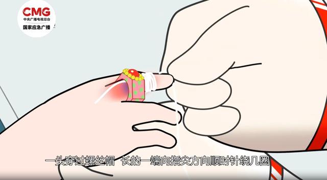 提醒！廚房這個地方利如刀片，千萬不要伸手進去→ - 