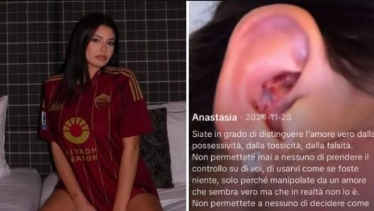 皮西利女友透露自己曾被前男友虐待：不要讓別人控制你