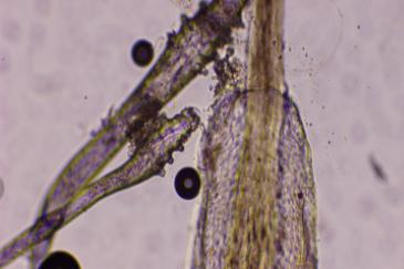 “過年三件套”爆火，第一批受害者出現了……醫生提醒：千萬注意！