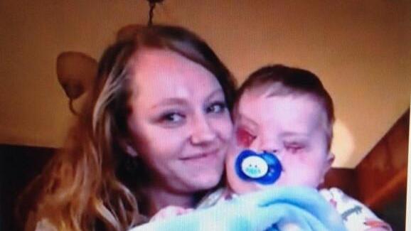 孩子，虽然你天生唇腭裂，没有双眼，但依然是我一生的挚爱