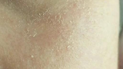 补水知识
1.多喝水，充足水分助于身体进行代谢。
2.敷面膜后应涂抹护肤品以