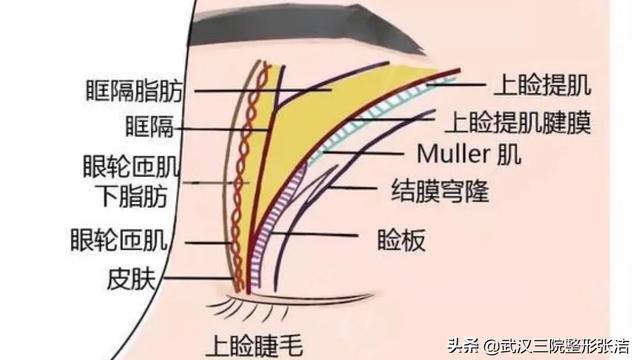 “提肌”能否处理好直接决定了做完的双眼皮是否好看，如果手术没有处理好提肌也就