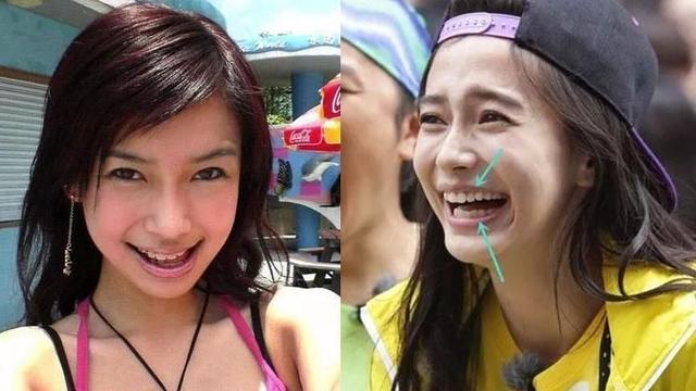 比“法令纹”更可怕的是“嘴凸”，显老苦相又土气，太多人遭殃了