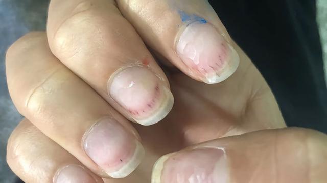 发霉、变灰、分层……如何守护“指尖上的美丽”？