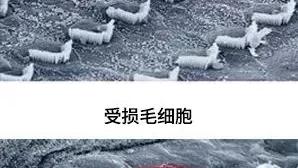“耳机党”注意！这些习惯正在偷走你的听力……