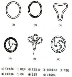 什么时候可以上环，女性什么时候上环（什么时候上环比较合适）