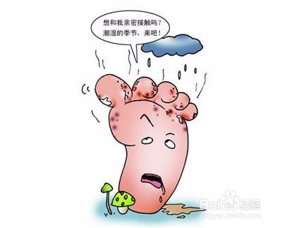 土法治疗灰指甲，灰指甲的治疗方法（做个随时可以脱鞋的）