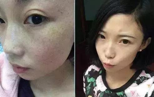 牙膏加一物可快速祛斑,牙膏加什么可以祛斑(牙膏加点它竟是很好的祛斑面膜) 牙膏加一物可快速祛斑,牙膏加什么可以祛斑(牙膏加点它竟是很好的祛斑面膜)