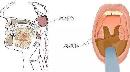 新生儿睡觉打呼噜正常吗，婴儿睡觉打呼噜正常吗（婴儿睡觉打呼可能是哪些方面的问题）