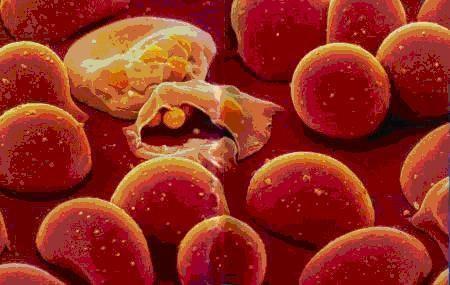 蜱虫病（蜱虫病毒），“蜱虫病”导致妇女死亡（什么叫蜱虫病）