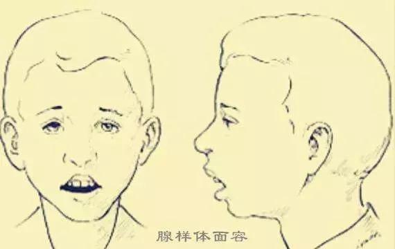 新生儿睡觉打呼噜正常吗，婴儿睡觉打呼噜正常吗（婴儿睡觉打呼可能是哪些方面的问题）