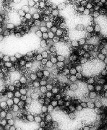 诺贝尔发明了什么，诺贝尔发明了什么火药（诺贝尔的发明和他的”以毒攻毒“的想法）