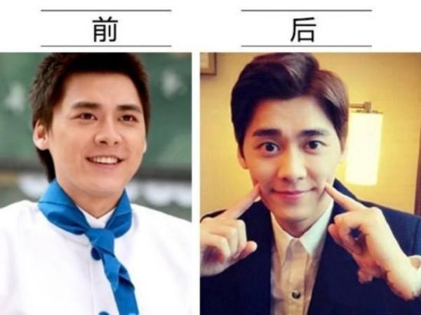 13位男星今夕对比照，从其貌不扬到花样美男，是整了还是减了？
