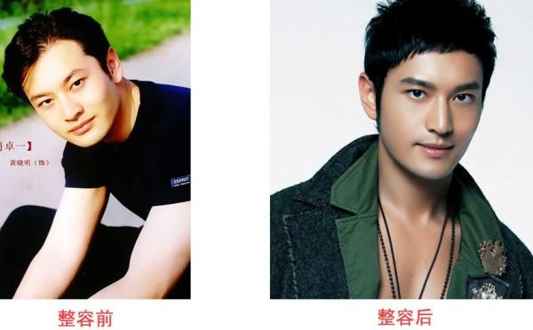 13位男星今夕对比照，从其貌不扬到花样美男，是整了还是减了？