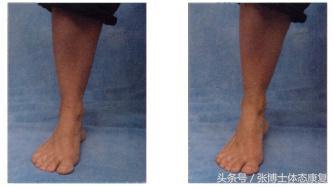 正确的站姿姿势，基本站姿注意（维持良好的身体姿态）