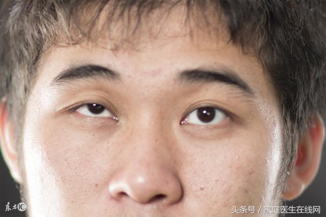 眼角跳动频繁是什么原因引起的,眼角偶尔会跳什么原因(可能是身体有这3个大问题) 眼角跳动频繁是什么原因引起的,眼角偶尔会跳什么原因(可能是身体有这3个大问题)