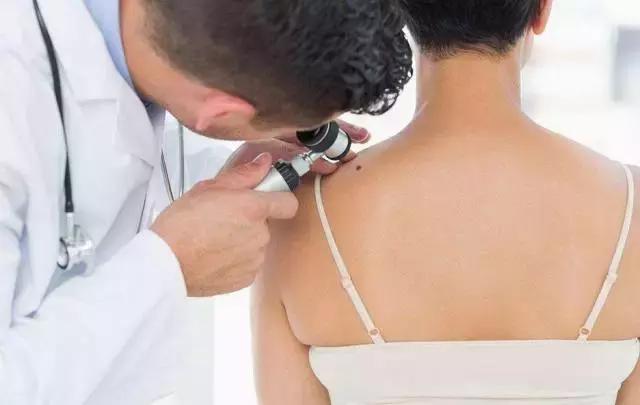 痣缘宫点痣靠谱吗，为什么痣缘宫点痣很贵（这是一篇写痣最为全面的面相文）