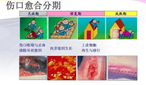 面条是发物吗，皮肤病忌口发物一览表（别再被“发物”吓到了）
