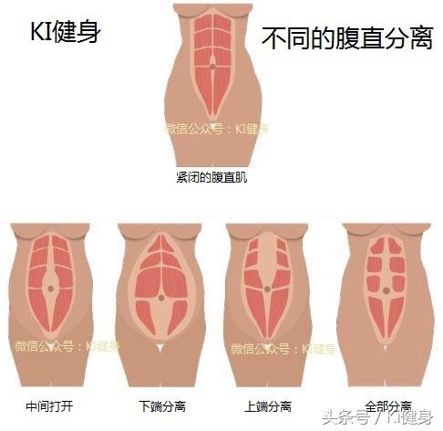 内脏图，腹直肌运动学解剖以及腹直分离问题（内脏图片 位置图）