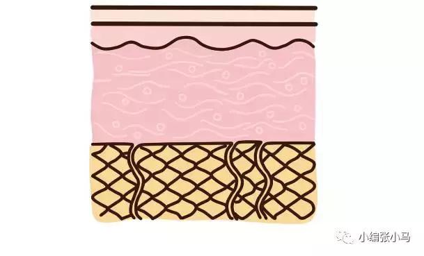 橘皮纹和肥胖纹的区别傻傻分不清,橘皮纹还是肥胖纹,要如何去除 橘皮纹和肥胖纹的区别傻傻分不清,橘皮纹还是肥胖纹,要如何去除