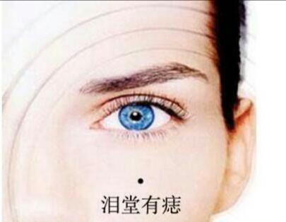 女人左眼角有痣代表什么，这3个地方有痣的女人
