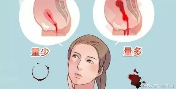 月经期量少吃什么可以加大出血量，月经期间吃什么可以增加月经量（经期血量过少，还可以练瑜伽吗）