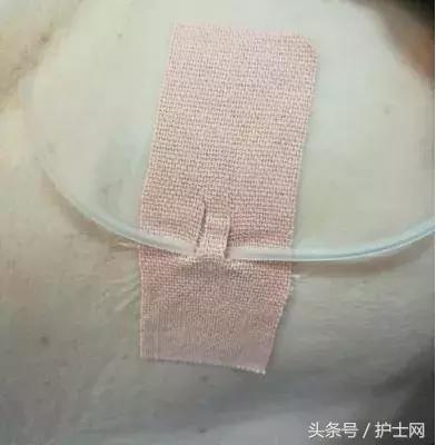 导尿管多少厘米，一般导尿管有多长（这个小发明让导管的二次固定更简单）