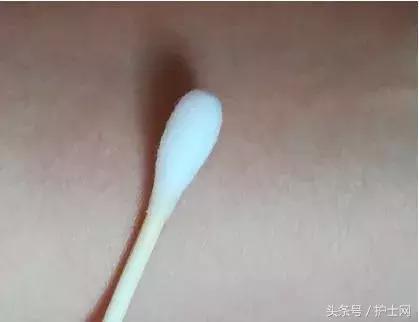 导尿管多少厘米，一般导尿管有多长（这个小发明让导管的二次固定更简单）