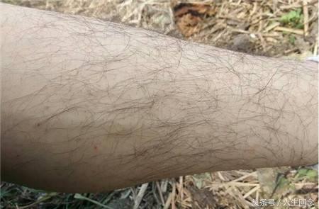 一勺盐两勺糖去唇毛有用吗，自己在家去唇毛小妙招（女生汗毛重可以改善吗）