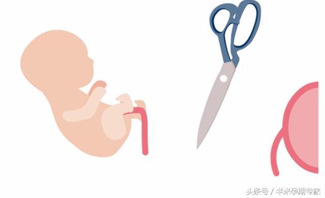 产程是什么，产程是什么级期刊（顺产的三大产程是什么）