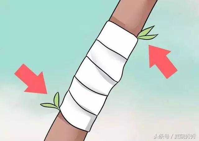 嫁接树苗的方法和技术，苗木嫁接与培育技术（果树最常用的5种嫁接方法！）