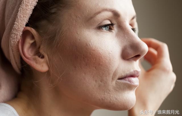 缩小鼻头的方法，缩小鼻头的自然方法（只能通过手术解决吗）