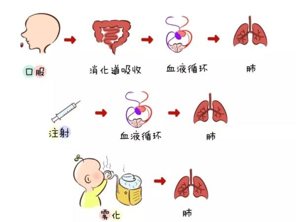 咳嗽雾化效果好吗，小孩子做雾化的利弊（孩子咳嗽要不要雾化吗）