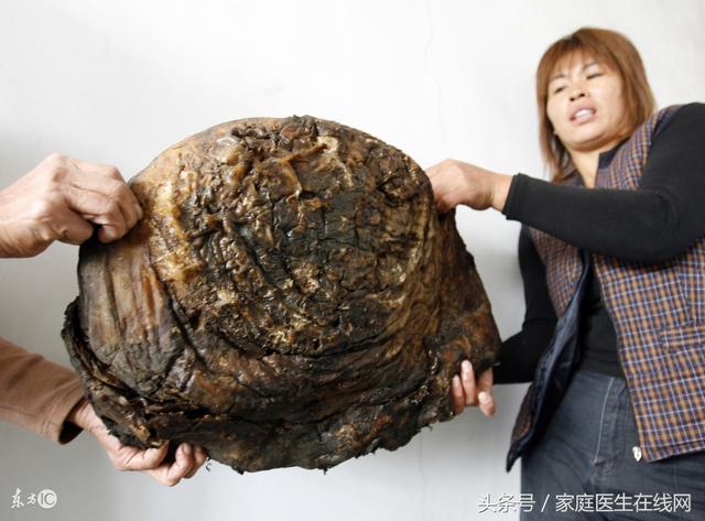 太岁是什么东西，犯太岁是什么意思（太岁具有这4大养生保健功效）