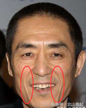 法令纹深长，法令纹会越来越深吗（将会有非常可怕的结局）