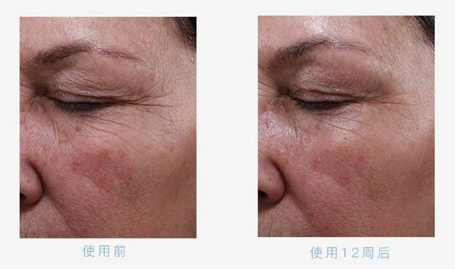 日抛是什么意思，次抛是什么意思（“日抛脸”真的好吗）