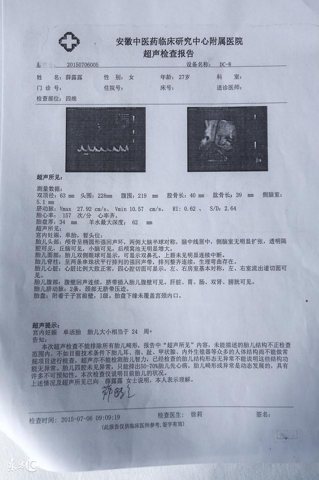 四维是什么意思，四维空间是什么意思（为了能提前知道胎儿性别）