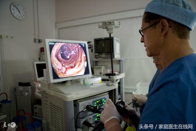 肠镜能查出什么，肠镜可以查出哪些疾病（这10类人定期做好肠镜检查）