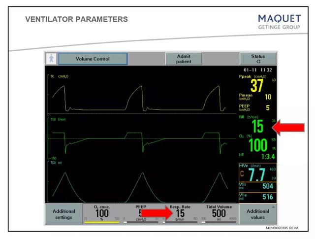 5个呼吸机常见参数设置，呼吸机各种模式需要调的参数（送给临床小白——呼吸机模式及参数设置图文详解）