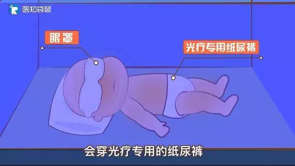 黄疸指数正常值,黄疸指数正常值是多少(宝宝黄疸值多高要住院) 黄疸指数正常值,黄疸指数正常值是多少(宝宝黄疸值多高要住院)