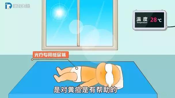 黄疸指数正常值,黄疸指数正常值是多少(宝宝黄疸值多高要住院) 黄疸指数正常值,黄疸指数正常值是多少(宝宝黄疸值多高要住院)