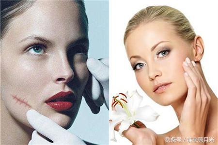 淡化疤痕的6个小妙招，淡化疤痕有效4个小妙招（去疤的方法有哪些）