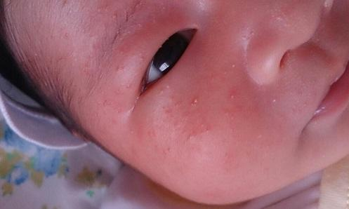 母乳可以天天洗脸吗，母乳能自己洗脸吗（原来是妈妈用这水给孩子洗脸）