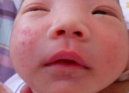 母乳可以天天洗脸吗，母乳能自己洗脸吗（原来是妈妈用这水给孩子洗脸）